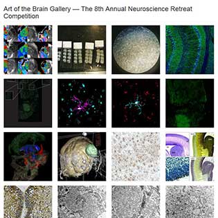 Art of the Brain - Call for images